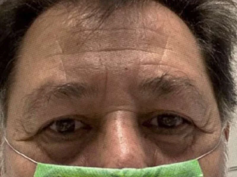 Rasca huele